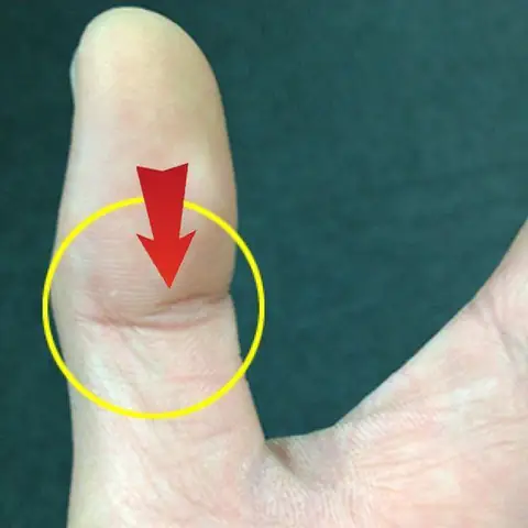 Vân Mắt Phượng Là Gì? Hình Ảnh Và Ý Nghĩa Chi Tiết