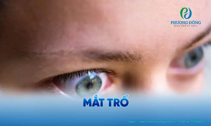 Học Làm Gì Cho Đầu To Mắt Trố