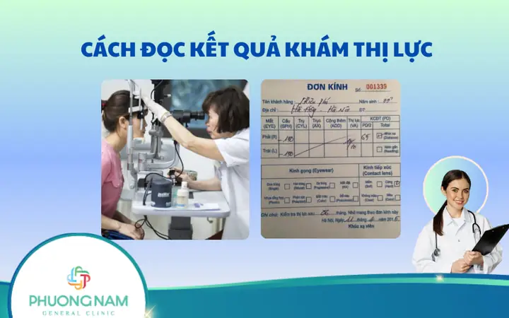 Cách Đọc Kết Quả Khám Thị Lực Chuẩn: Hiểu Ngay Các Thông Số Để Chọn Kính Thuốc Phù Hợp