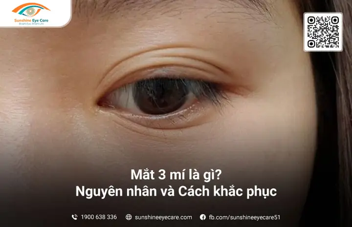 Khắc Phục Mắt 3 Mí Tại Nhà: Phương Pháp An Toàn Và Hiệu Quả