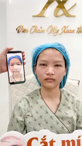 Khoảng Cách Giữa 2 Mắt Xa Nhau: Phân Tích & Giải Pháp Cải Thiện Toàn Diện