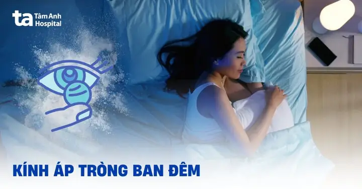 Kính Áp Tròng Ban Đêm Ortho-k: Tất Tần Tật Bạn Cần Biết