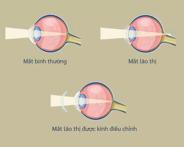 Kính Lão Là Kính Gì? Giải Đáp Chi Tiết Về Công Nghệ Kính Thông Minh