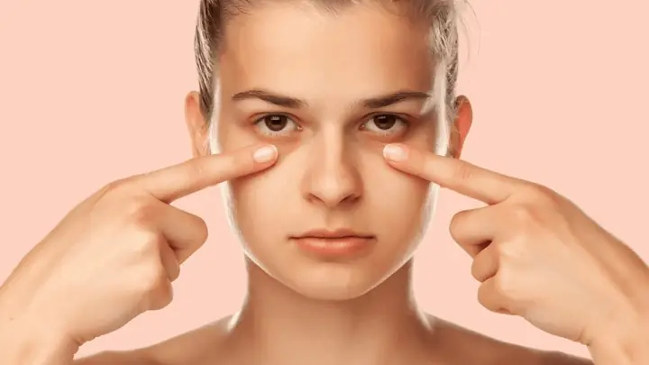 Cách Hết Thâm Mắt Hiệu Quả Và An Toàn: Tổng Hợp Từ A Đến Z