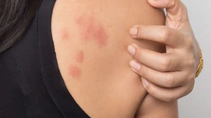 Làm Sao Để Hết Dị Ứng Lông Mèo