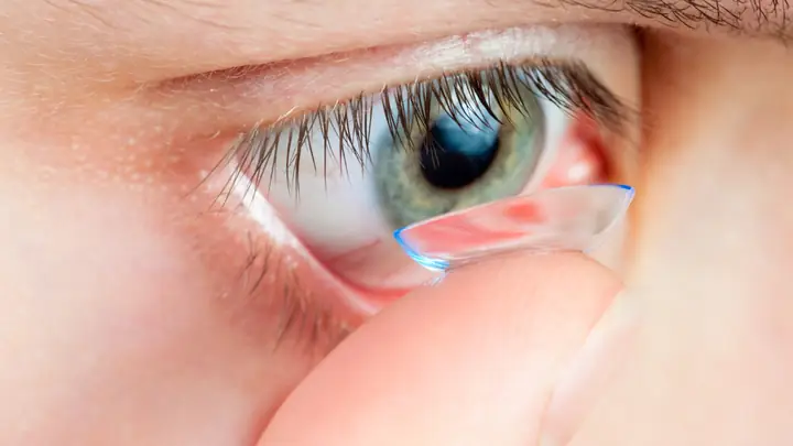 Lens 1 Ngày Có Cần Ngâm Trước Khi Đeo Không? Giải Đáp Từ A Đến Z
