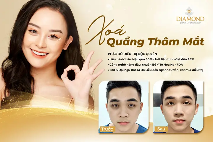 Top 7 Liệu Trình Trị Quầng Thâm Mắt Được Đánh Giá Cao Nhất