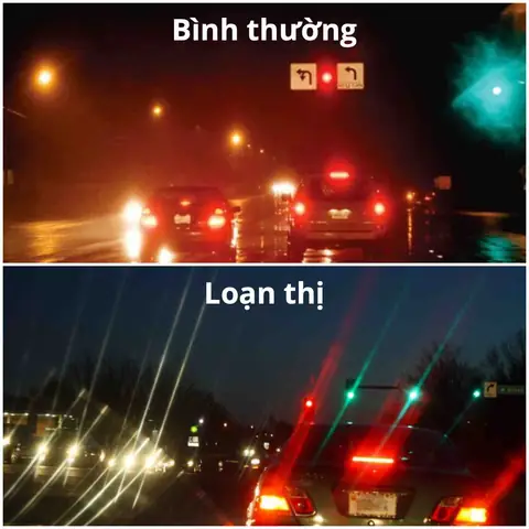 Loạn Thị Là Gì? Tổng Quan Từ A-z Về Bệnh Cận Thị Phổ Biến