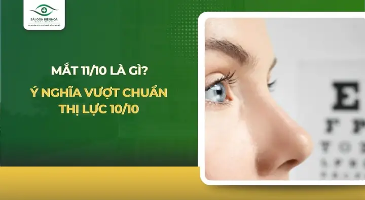 Mắt 11/10 Là Gì? Tổng Tất Tần Tật Từ A Đến Z