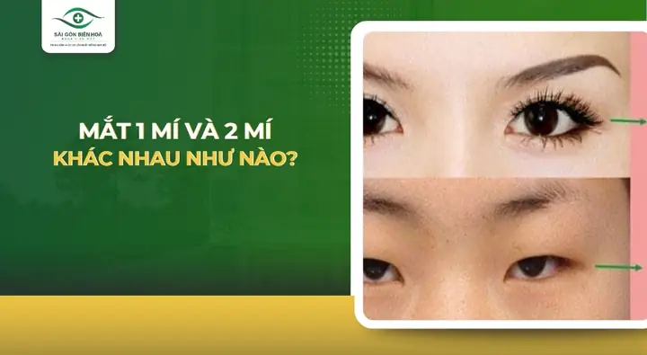 Mắt 1 Mí Và 2 Mí: Tổng Quát Từ Khái Quát Đến Chi Tiết