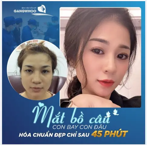 Mắt Bồ Câu Đậu Cánh: Đánh Giá Chi Tiết Về Đặc Điểm, Tập Tính Và Giá Trị