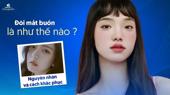 Mắt Buồn Là Gì? Nguyên Nhân, Ý Nghĩa & Cách Khắc Phục Hiệu Quả