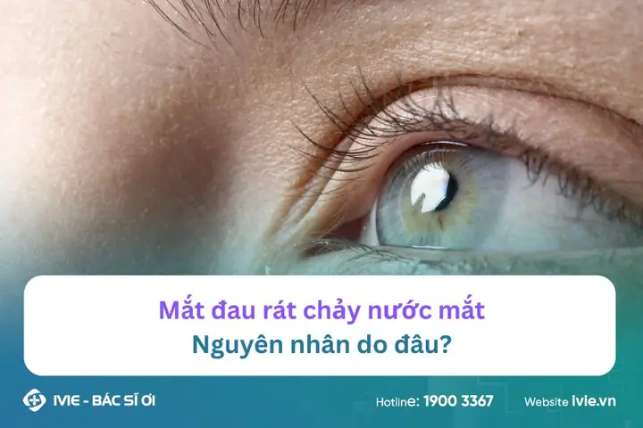 Mắt Đau Rát Chảy Nước Mắt: Nguyên Nhân Và Cách Xử Lý Tại Nhà