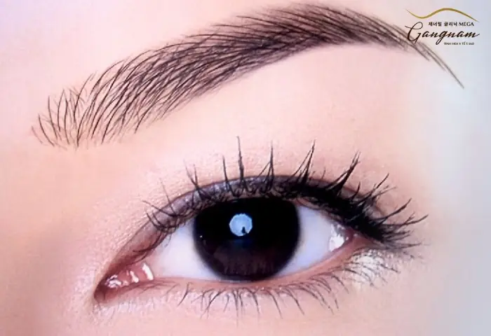 Mắt Lá Liễu Là Gì? Tổng Tất Tất Về Đặc Điểm, Phong Thủy Và Cách Khắc Phục