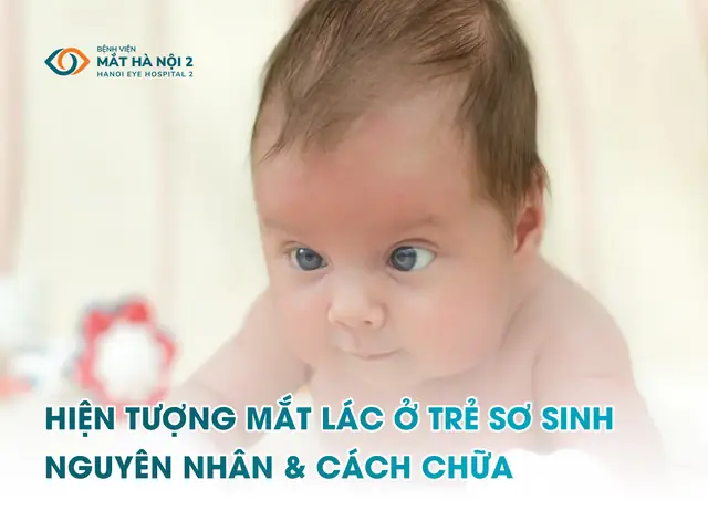 Mắt Lác Ở Trẻ Sơ Sinh: Từ Hiện Tượng Thường Gặp Đến Giải Pháp Can Thiệp