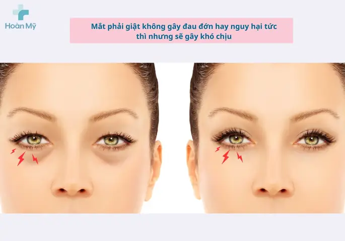 Mắt Phải Giật Liên Tục: Nguyên Nhân, Cách Xử Lý Và Khi Nào Cần Đi Khám?