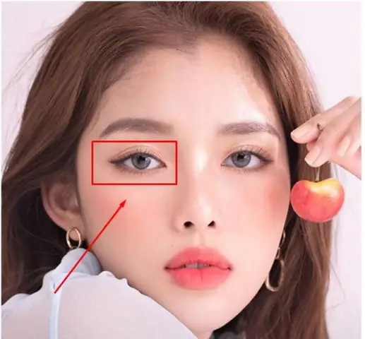 Mắt Phải Yếu Hơn Mắt Trái: Điều Cần Biết Về Chênh Lệch Thị Lực
