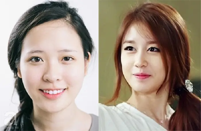 Mắt To Mắt Nhỏ: Nguyên Nhân & Giải Pháp Khắc Phục Hiệu Quả