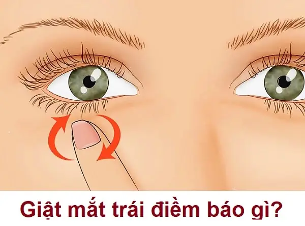 Mắt Trái Giật Cả Ngày: Nguyên Nhân Và Cách Khắc Phục Hiệu Quả
