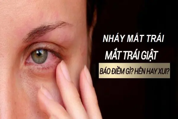Mắt Trái Giật: Giải Mã Khoa Học Và Quan Niệm Dân Gian