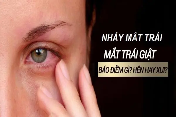 Mắt Trái Giật Ở Nam Giới Là Gì? Nguyên Nhân Và Cách Xử Lý