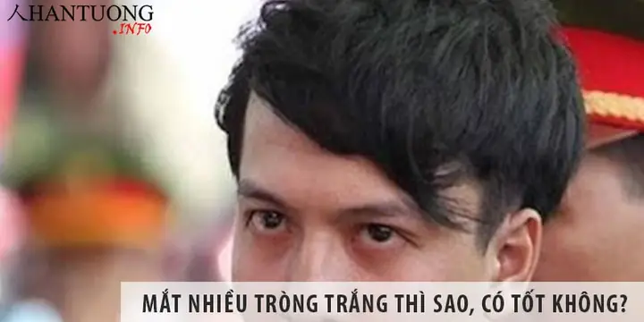 Mắt Tròng Trắng Nhiều Hơn Tròng Đen: Nguyên Nhân Và Giải Đáp