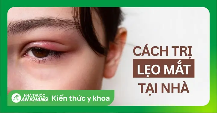 Mẹo Trị Lẹo Mắt Nhanh Nhất: 7 Cách Thực Hiện Đơn Giản Tại Nhà