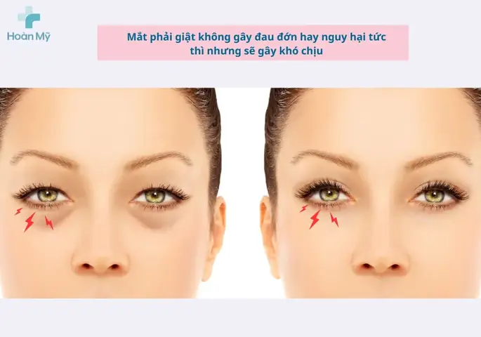 Mí Mắt Giật Liên Tục Là Bệnh Gì