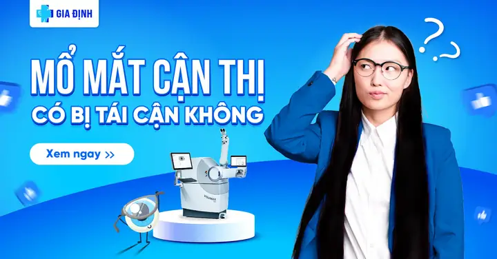 Mổ Mắt Cận Có Khỏi Hẳn Không? Phân Tích Toàn Diện Từ Chuyên Gia