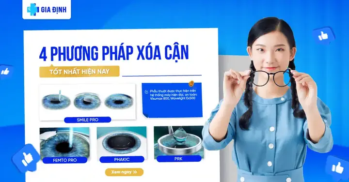 Nên Mổ Mắt Cận Theo Phương Pháp Nào