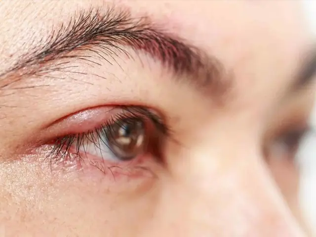 Ngủ Dậy Bị Đau Một Bên Mắt Phải: Nguyên Nhân Và Cách Xử Lý Đúng Cách