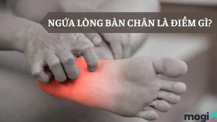 Ngứa Lòng Bàn Chân Là Điềm Gì? Giải Mã Ý Nghĩa & Cách Khắc Phục