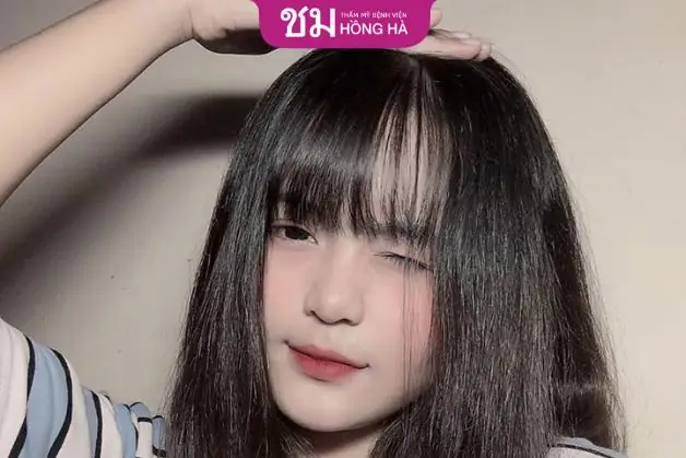 Nguyên Nhân Gây Đau Mắt Trái Và Cách Xử Lý Hiệu Quả