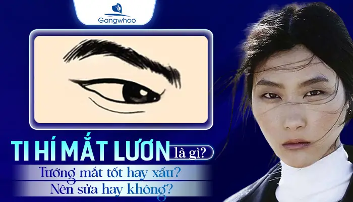 Những Người Ti Hí Mắt Lươn Là Gì? Nguyên Nhân Và Cách Xử Lý