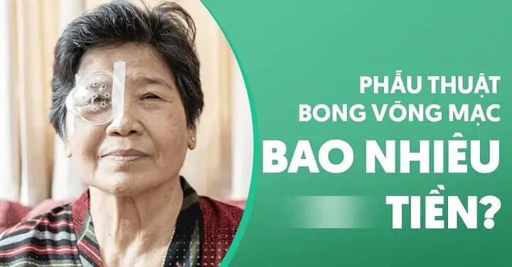 Phẫu Thuật Bong Võng Mạc Bao Nhiêu Tiền? Cập Nhật Chi Tiết 2026