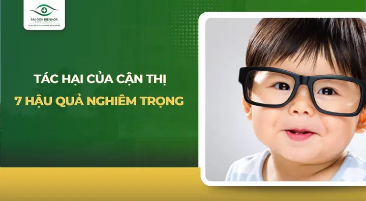 Tác Hại Cận Thị: Những Rủi Ro Sức Khỏe Bạn Cần Biết Ngay