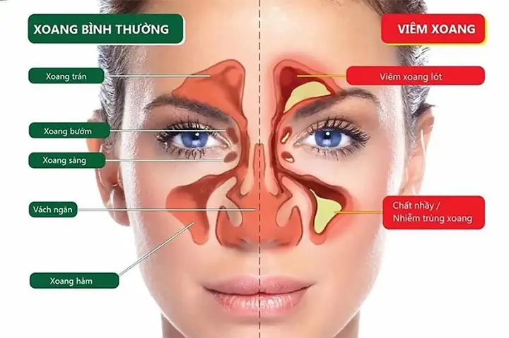 Tại Sao Có Nhiều Gỉ Mũi?