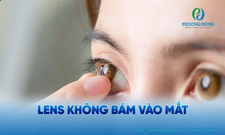Tại Sao Lens Không Dính Vào Mắt? Giải Đáp Chi Tiết