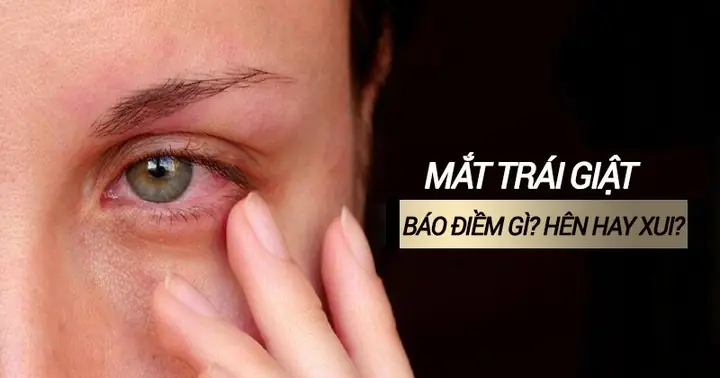 Tại Sao Mắt Trái Giật: Nguyên Nhân & Cách Xử Lý Chi Tiết