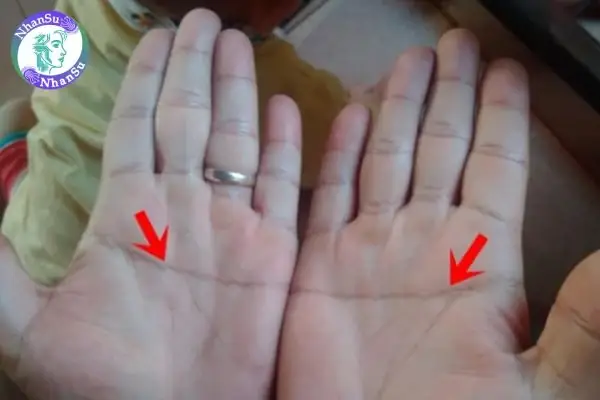 Bàn Tay Chữ Nhất Là Gì? Từ Hiếm Có Tiết Lộ Tính Cách Và Tiềm Năng Sự Nghiệp