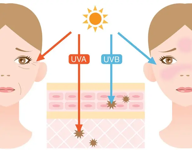 Tia Uv Chiếu Vào Mắt: Tác Hại Và Cách Bảo Vệ Mắt Hiệu Quả