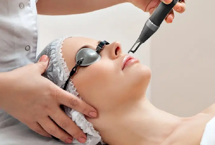 Hướng Dẫn Chi Tiết Về Điều Trị Thâm Quầng Mắt Bằng Laser