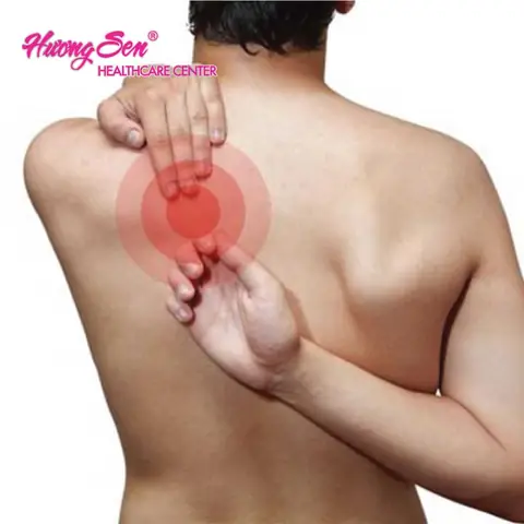 Tức Lưng Trên Bên Trái: Nguyên Nhân, Cách Xử Lý Và Khi Nào Cần Đi Khám