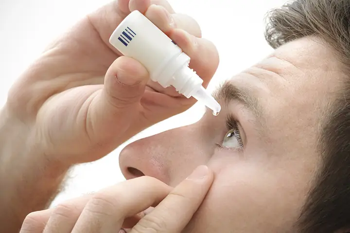 Viêm Kết Mạc: Tổng Tân Từ Nguyên Nhân, Triệu Chứng Đến Cách Điều Trị Hiệu Quả