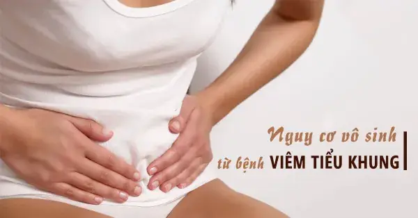 Viêm Tiểu Khung Là Gì? Nguyên Nhân, Triệu Chứng Và Cách Phòng Ngừa