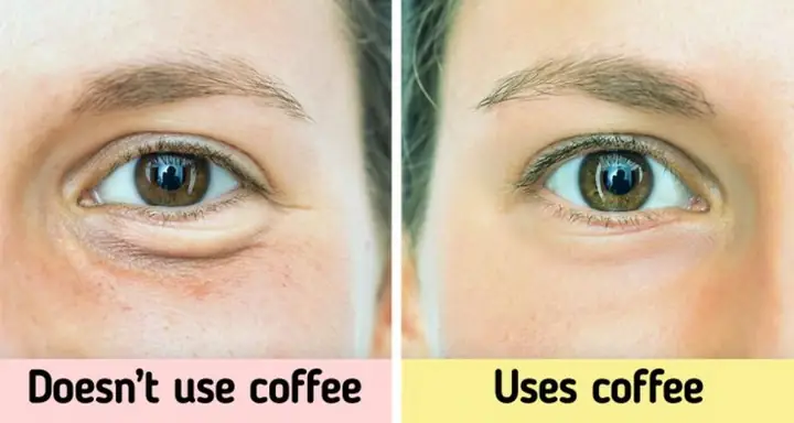 Cách Xóa Quầng Thâm Bọng Mắt Hiệu Quả: Tổng Hợp 8 Phương Pháp Khoa Học