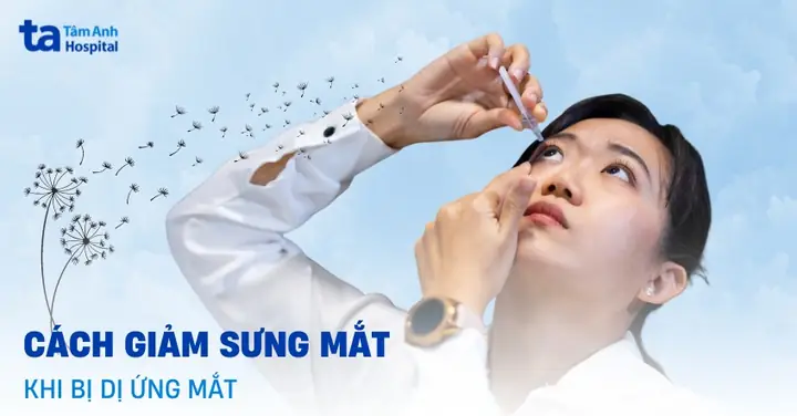 Cách Làm Hết Sưng Mắt Khi Bị Muỗi Đốt