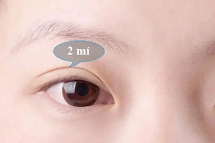 Làm Sao Để Biết Mắt Một Mí Hay Hai Mí
