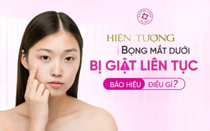 Mí Mắt Dưới Bị Giật Liên Tục: Điềm Báo Gì