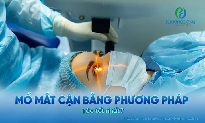 Mổ Mắt Cận Bằng Phương Pháp Nào Tốt Nhất